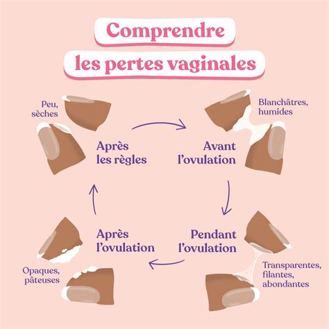 Pertes vaginales blanches, quand sinquiéter et quand。